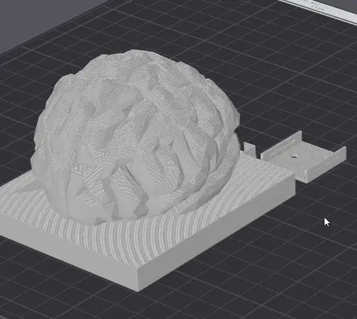 Brain